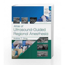 Atlas of Ultrasound-Guided Regional Anesthesia, 3e by Gray A T Book-9780323509510