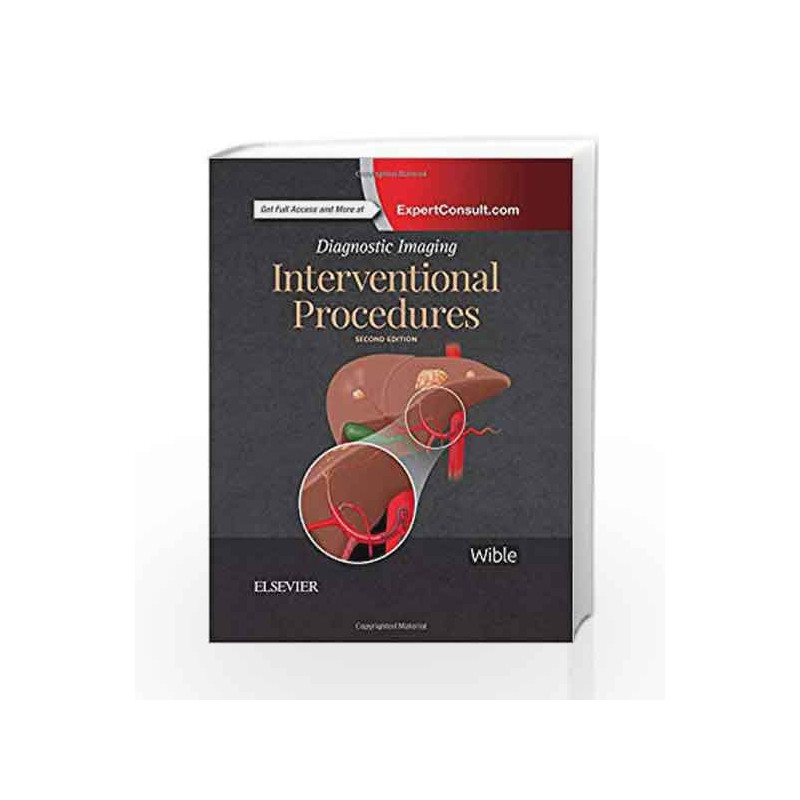 Diagnostic Imaging: Interventional Procedures, 2e by Wible B C Book-9780323524810
