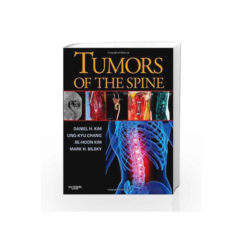 Tumors of the Spine by Kim,Kim D.H,Klimberg,Kreyger,Kryger,Kryger M.H. Book-9781416033677