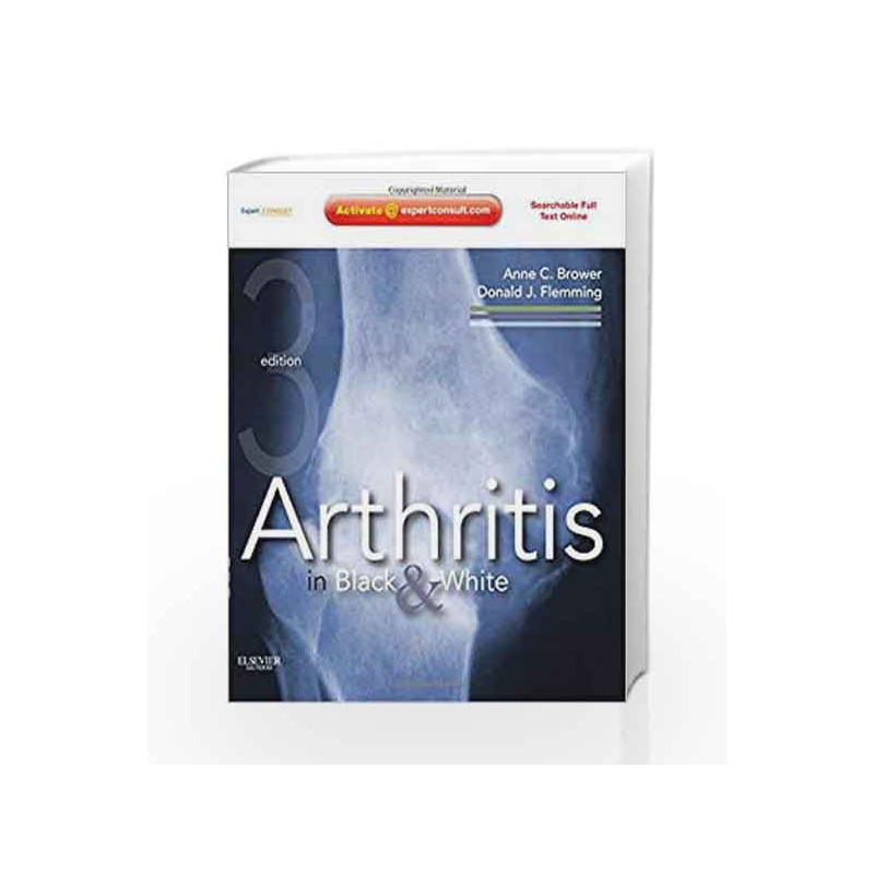 Arthritis in Black and White: Expert Consult - Online and Print by Brower A.C. Book-9781416055952