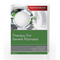 Therapy for Severe Psoriasis, 1e by Wu J J Book-9780323447973