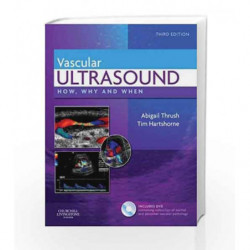 Vascular Ultrasound: How, Why and When by Thrush A. Book-9780443069185