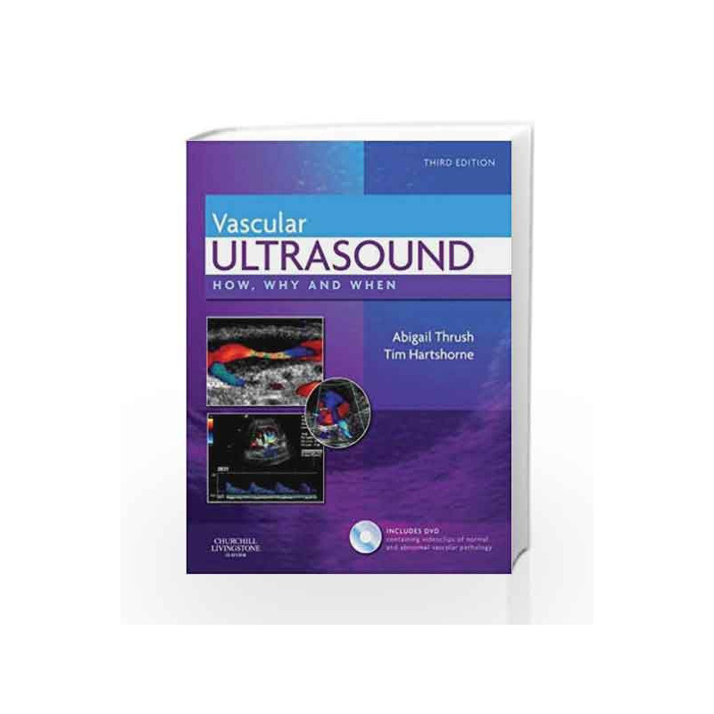 Vascular Ultrasound: How, Why and When by Thrush A. Book-9780443069185