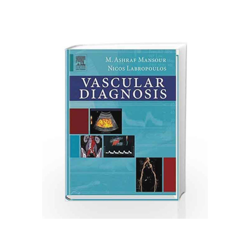 Vascular Diagnosis by Mansour M.A. Book-9780721694269
