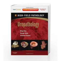 Uropathology: A Volume in the High Yield Pathology Series (Expert Consult - Online and Print) by Zhou M. Book-9781437725230