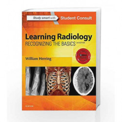 Learning Radiology: Recognizing the Basics by Herring W Book-9780323328074