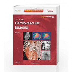 Cardiovascular Imaging, 2-Volume Set: Expert Radiology Series Expert Consult- Online and Print by Ho Book-9781416053354
