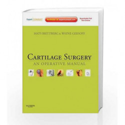 Cartilage Surgery: An Operative Manual, Expert Consult: Online and Print by Brittberg Book-9781437708783