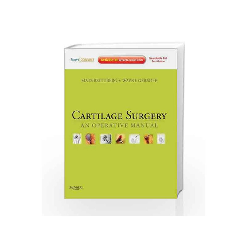 Cartilage Surgery: An Operative Manual, Expert Consult: Online and Print by Brittberg Book-9781437708783