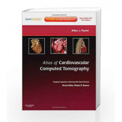 Atlas of Cardiovascular Computed Tomography: Expert Consult - Online and Print: Imaging Companion to Braunwald's Heart Disease (