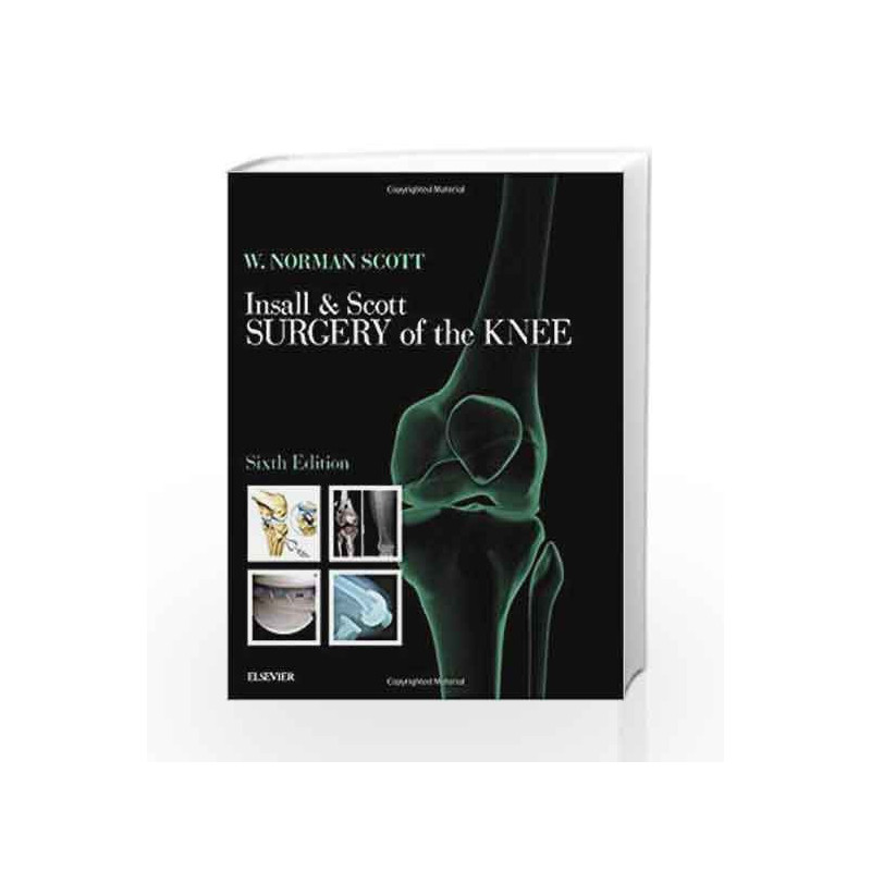 Insall & Scott Surgery of the Knee, 2-Volume Set, 6e by Scott W.N. Book-9780323400466