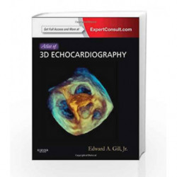 Atlas of 3D Echocardiography: Expert Consult - Online and Print by Gill E. A. Book-9781437726992