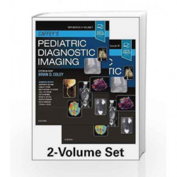 Caffey's Pediatric Diagnostic Imaging, 2-Volume Set, 13e by Coley B.D. Book-9780323497480