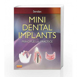 Mini Dental Implants: Principles and Practice by Sendax V. Book-9781455743865