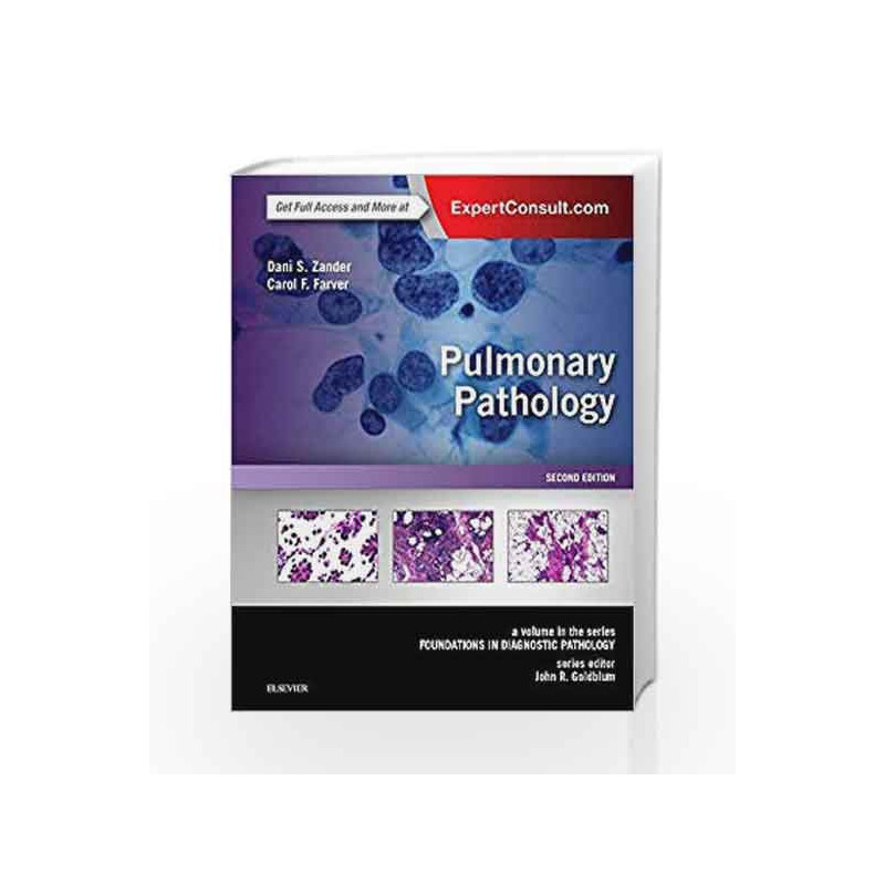 Pulmonary Pathology - A Volume in the Series: Foundations in Diagnostic Pathology by Zander D.S. Book-9780323393089