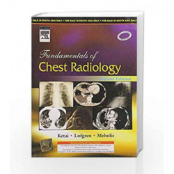 Fundamentals of Chest Radiology by Ketai Book-9788131219478