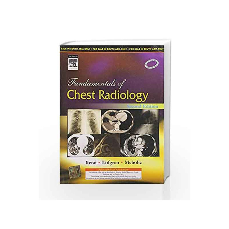 Fundamentals of Chest Radiology by Ketai Book-9788131219478