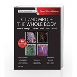 CT and MRI of the Whole Body (Set of 2 Volumes) by Haaga J.R. Book-9780323113281