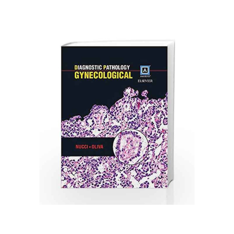 Diagnostic Pathology: Gynecological by Nucci M R Book-9781931884600