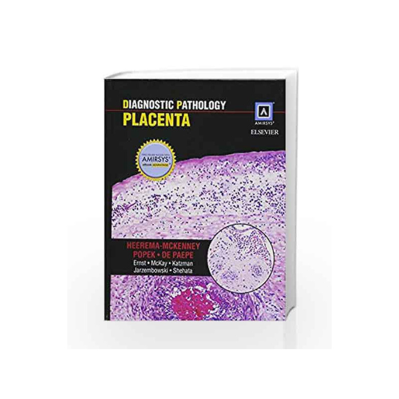 Diagnostic Pathology: Placenta by Mckenney A H Book-9781937242220