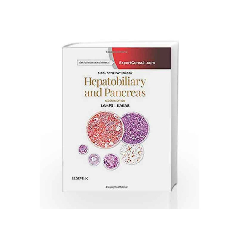 Diagnostic Pathology: Hepatobiliary and Pancreas, 2e by Lamps L W Book-9780323443074