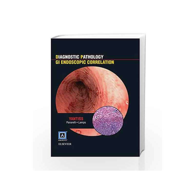 Diagnostic Pathology: GI Endoscopic Correlations by Yantiss R Book-9781937242206