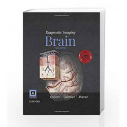 Diagnostic Imaging: Brain by Osborn A G Book-9780323377546
