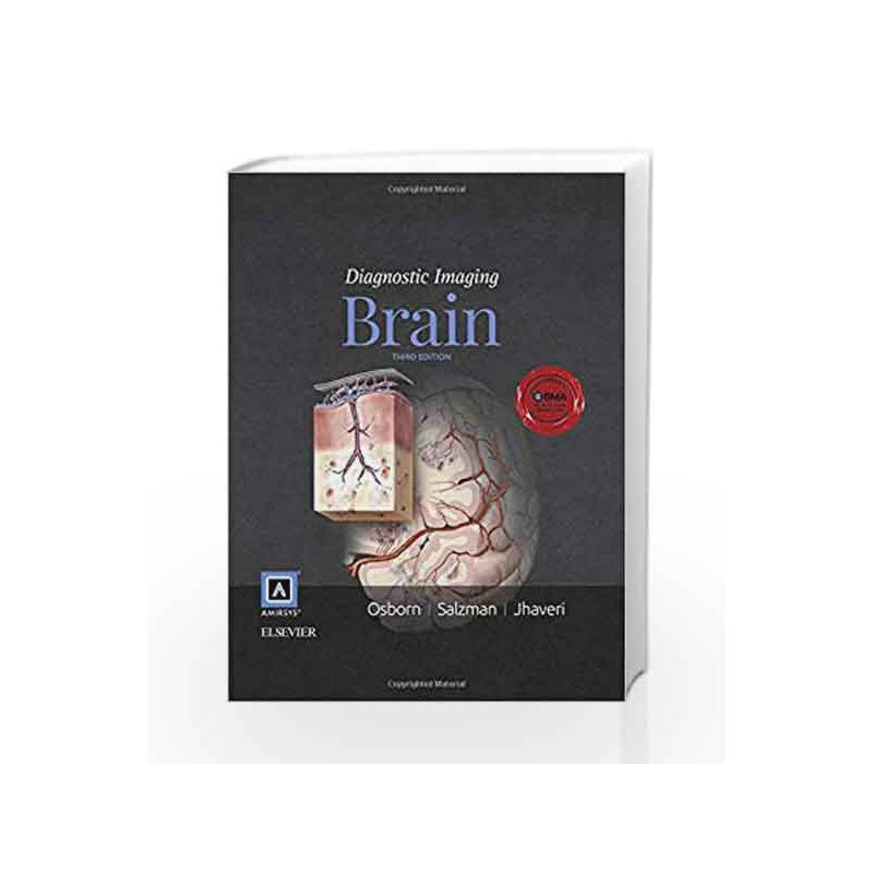 Diagnostic Imaging: Brain by Osborn A G Book-9780323377546
