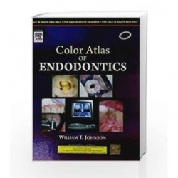 Colour Atlas of Endodontics by Johnson W.T. Book-9788131218334