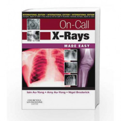 On-Call X-Rays Made Easy, International Edition by Au-Yong I Book-9780702034442