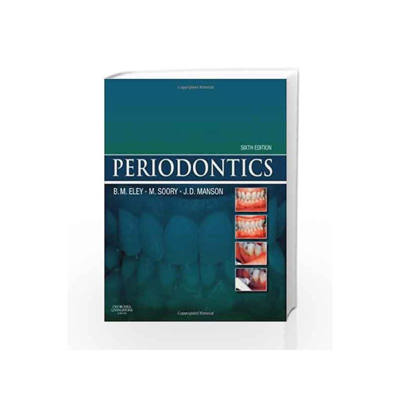 Periodontics by Eley B.M. Book-9780702030659