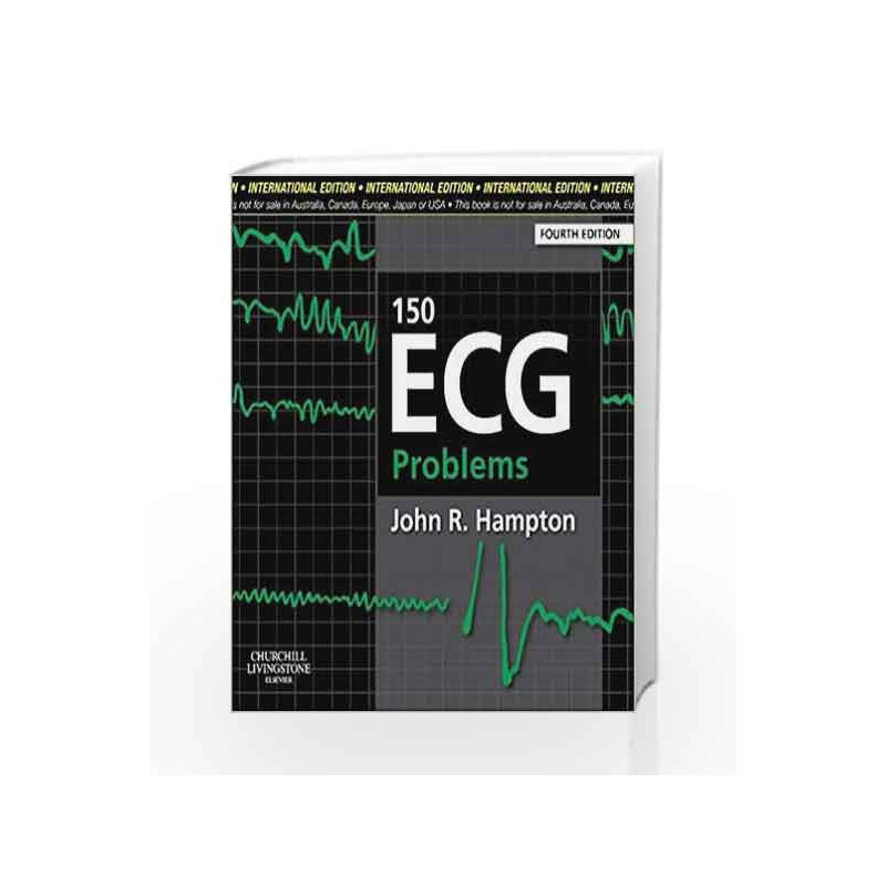150 ECG Problems, International Edition by Hampton J. R Book-9780702046711
