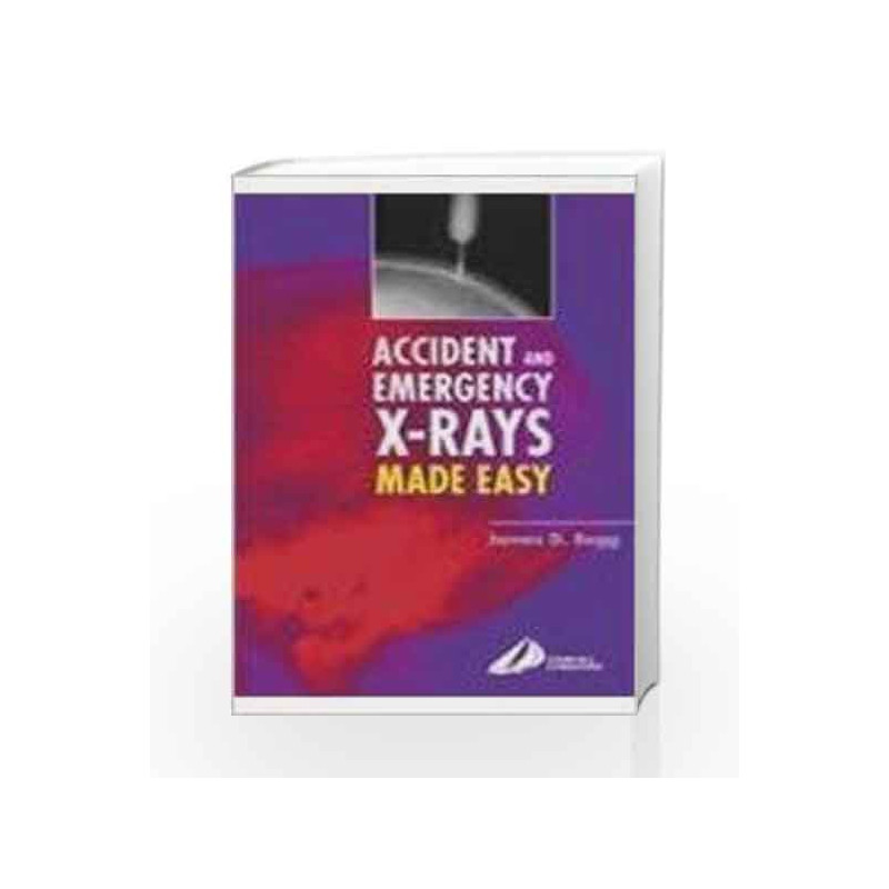 Accident and Emergency X-rays Made Easy, International Edition by Begg Book-9780443073250