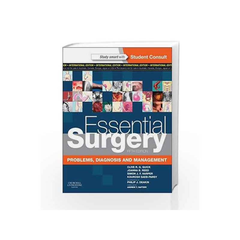 Essential Surgery: Problems, Diagnosis and Management With Student Consult Online Access, International Edition (MRCS Study Guid
