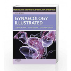 Gynaecology Illustrated, International Edition by Bain C.M. Book-9780702030772