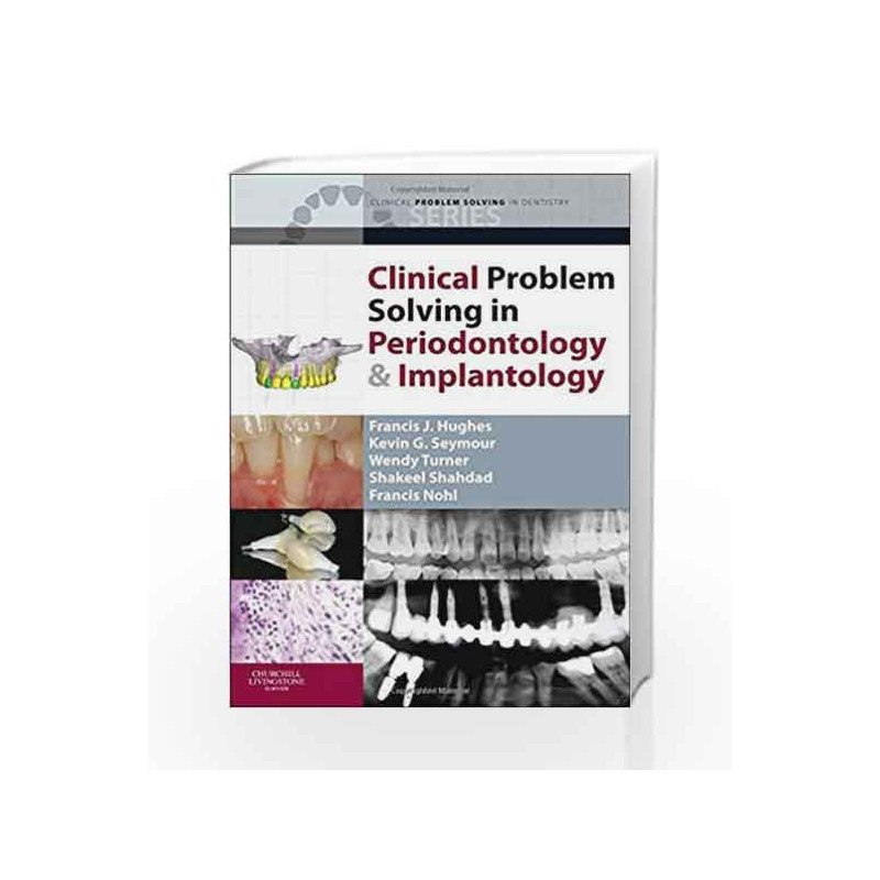 Clinical Problem Solving in Periodontology and Implantology (Clinical Problem Solving in Dentistry) by Hughes Book-9780702037405