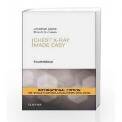 ChestX-Ray Made Easy, International Edition by Corne Book-9780702055003