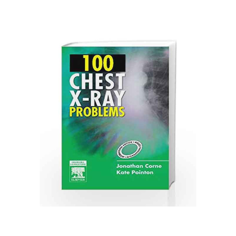 100 Chest X-Ray Problems by Corne J Book-9780443103773