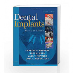 Dental Implants: The Art and Science by Babbush Book-9781416053415