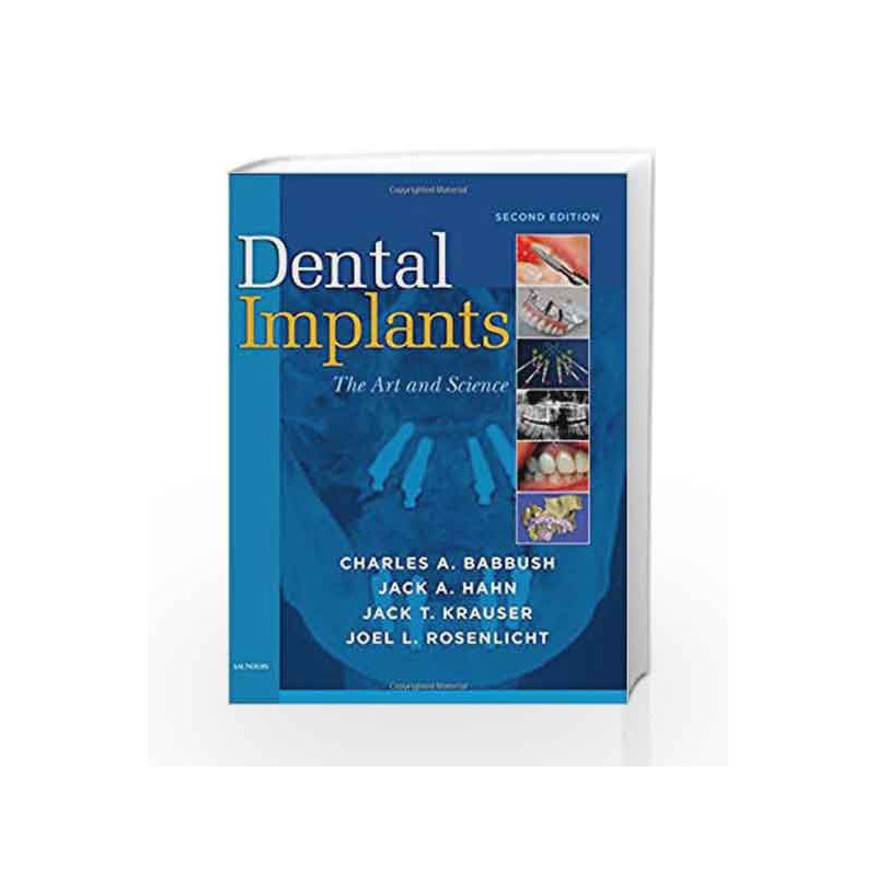Dental Implants: The Art and Science by Babbush Book-9781416053415