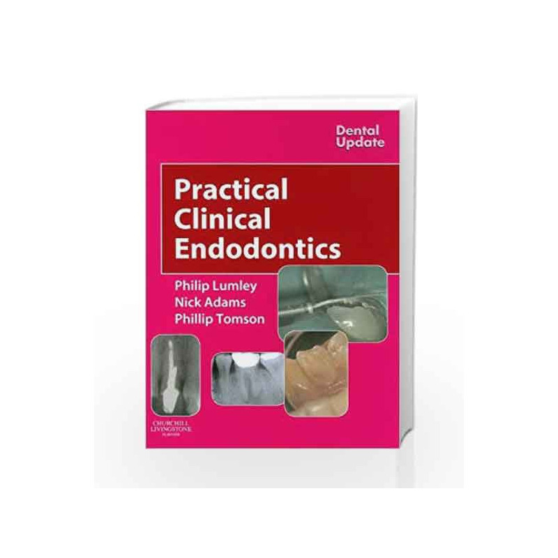 Practical Clinical Endodontics (Dental Update) by Lumley Book-9780443074820