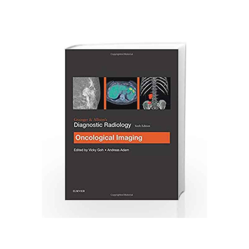 Grainger & Allison's Diagnostic Radiology: Oncological Imaging, 6e by Goh V Book-9780702069352