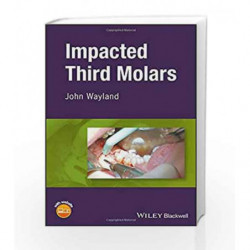 Impacted Third Molars by Wayland J Book-9781119118336
