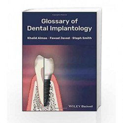 Glossary of Dental Implantology by Almas K Book-9781118626887