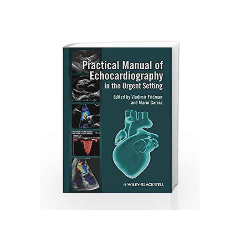 Practical Manual of Echocardiography in the Urgent Setting by Fridman V.E. Book-9780470659977