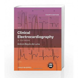 Clinical Electrocardiography: A Textbook by De Luna A.B. Book-9780470658598
