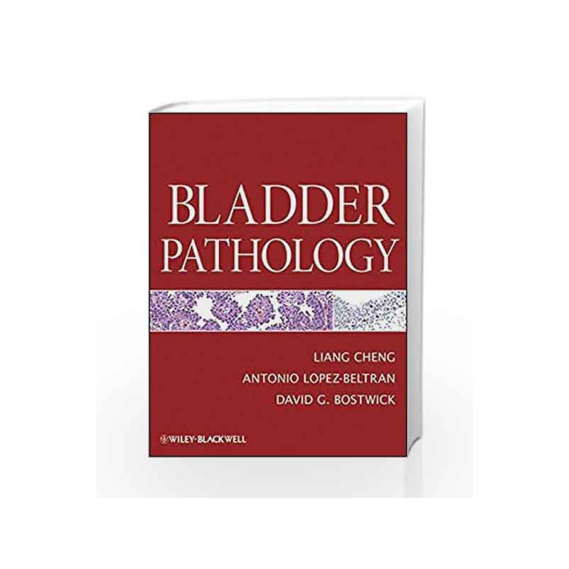 Bladder Pathology by Cheng-Buy Online Bladder Pathology Book at Best ...