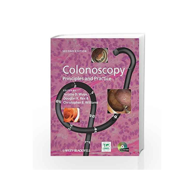 Colonoscopy: Principles and Practice by Waye Book-9781405175999