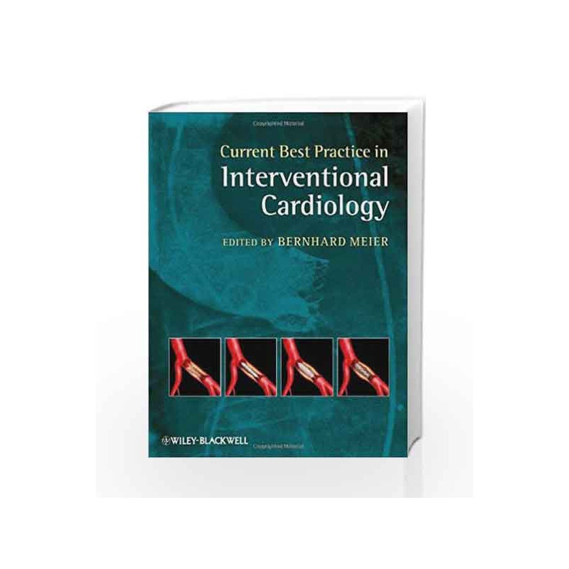 Current Best Practice in Interventional Cardiology by Meier B. Book-9781405182553