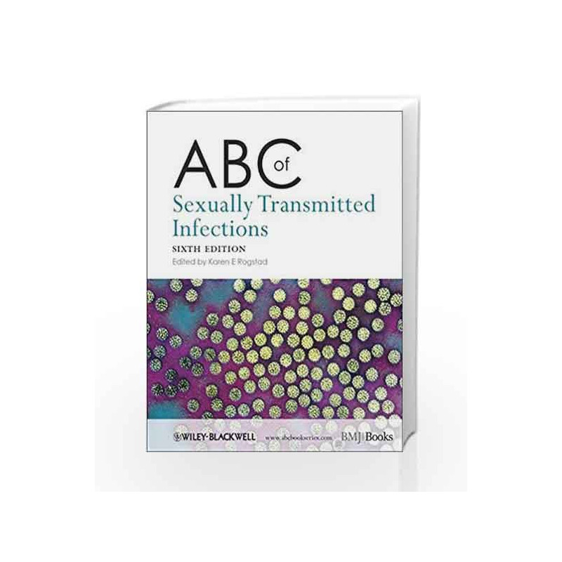 ABC of Sexually Transmitted Infections (ABC Series) by Rogstad K.E. Book-9781405198165